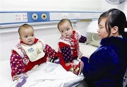 连体双胞胎坐骨连在一起,首例坐骨连体分离11年