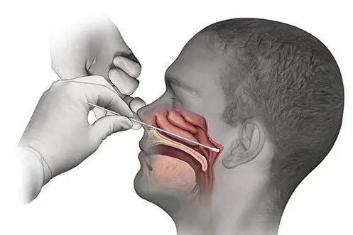 医生做肠胃镜全过程,顶级医院做胃镜