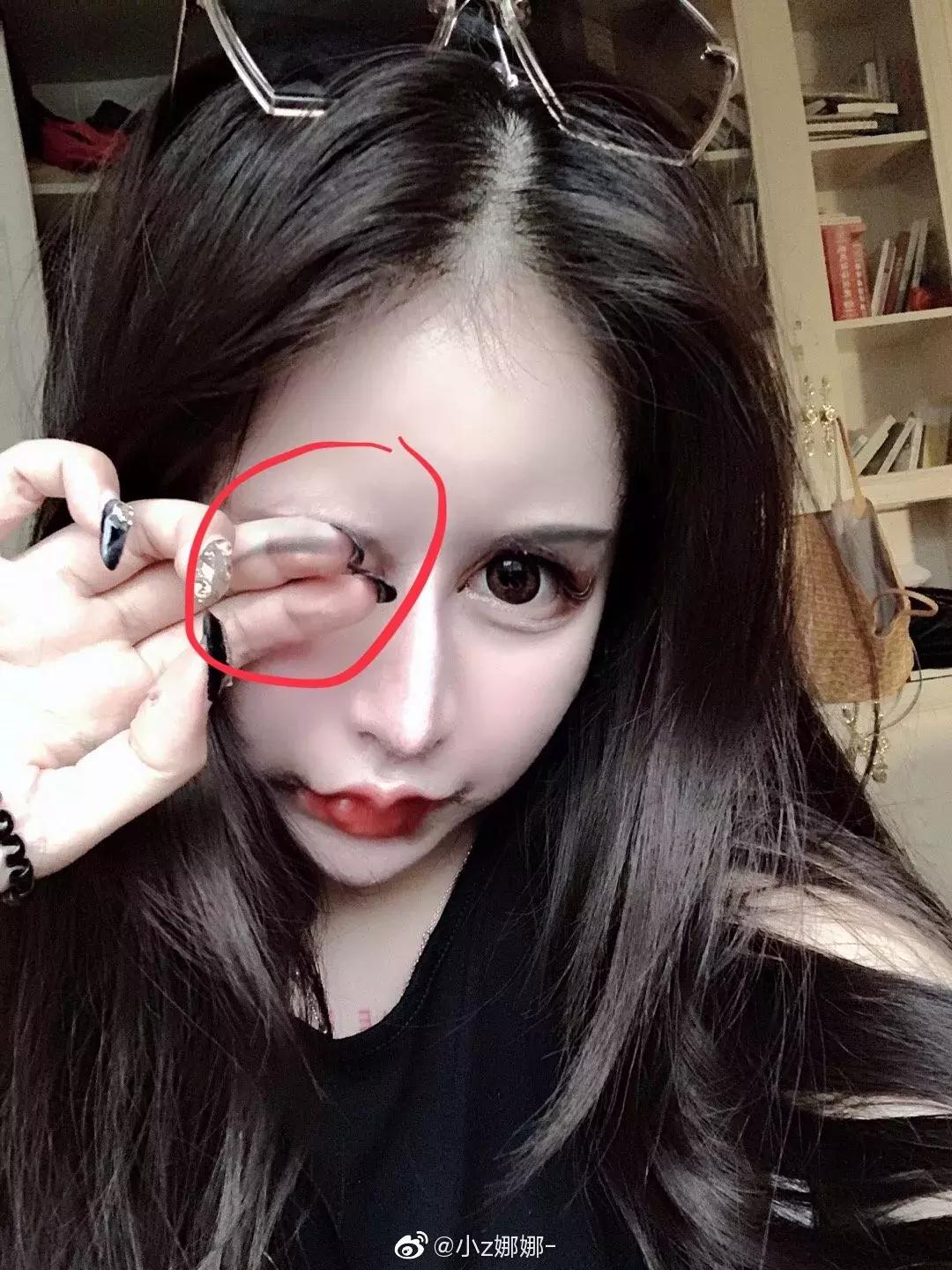 13岁开始整容，视李蒽熙为偶像！小Z娜娜是疯了吗？