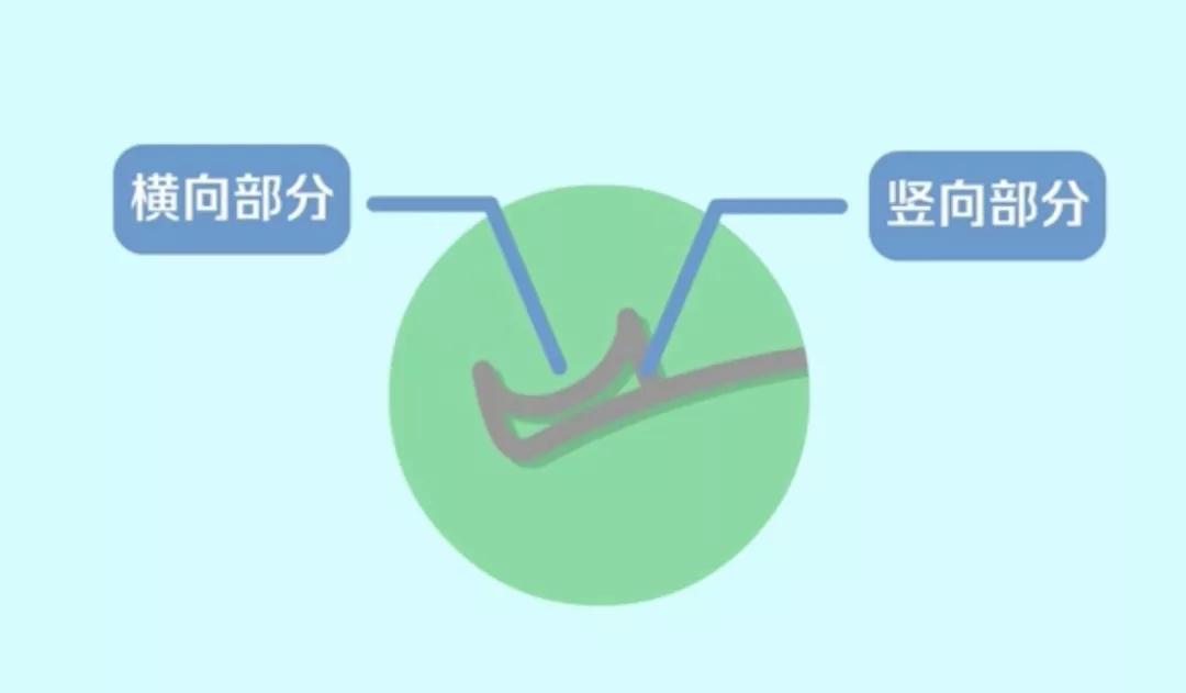 激光手术近视变成远视怎么办,激光近视手术再近视怎么办