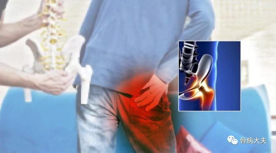 求问中医下肢无力是什么原因,双腿外侧怕冷是股骨头坏死吗