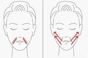 法令纹又深又长最好的解决办法,法令纹最显老怎么去除法令纹