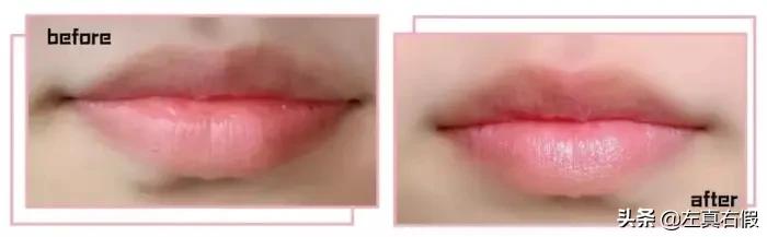 鏃ユ湰dhc鍞囪啅浣滅敤,dhc鍞囪啅浼氬彉鑹插悧