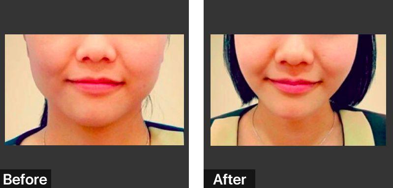 她靠“脸崩”博出位，曾经的女王要“凉凉”