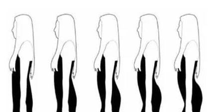 什么是骨盆前倾和后倾图片,男性骨盆前倾是什么样的