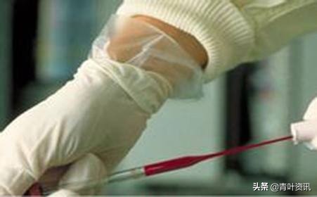 得了尖锐性湿疣怎么缓解焦虑,尖锐性湿疣初期容不容易破