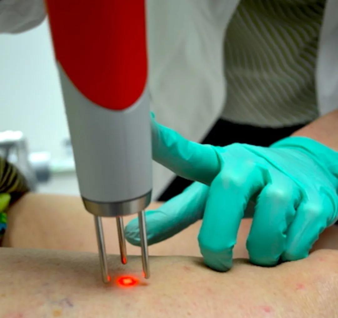 痣真的有那么大的癌变几率吗,痣会癌变真的很可怕吗