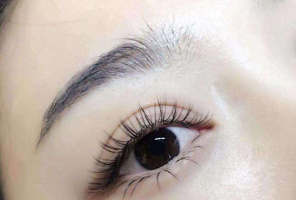 为什么身体起疙瘩一样的包,身体到处都是密密麻麻的包怎么办