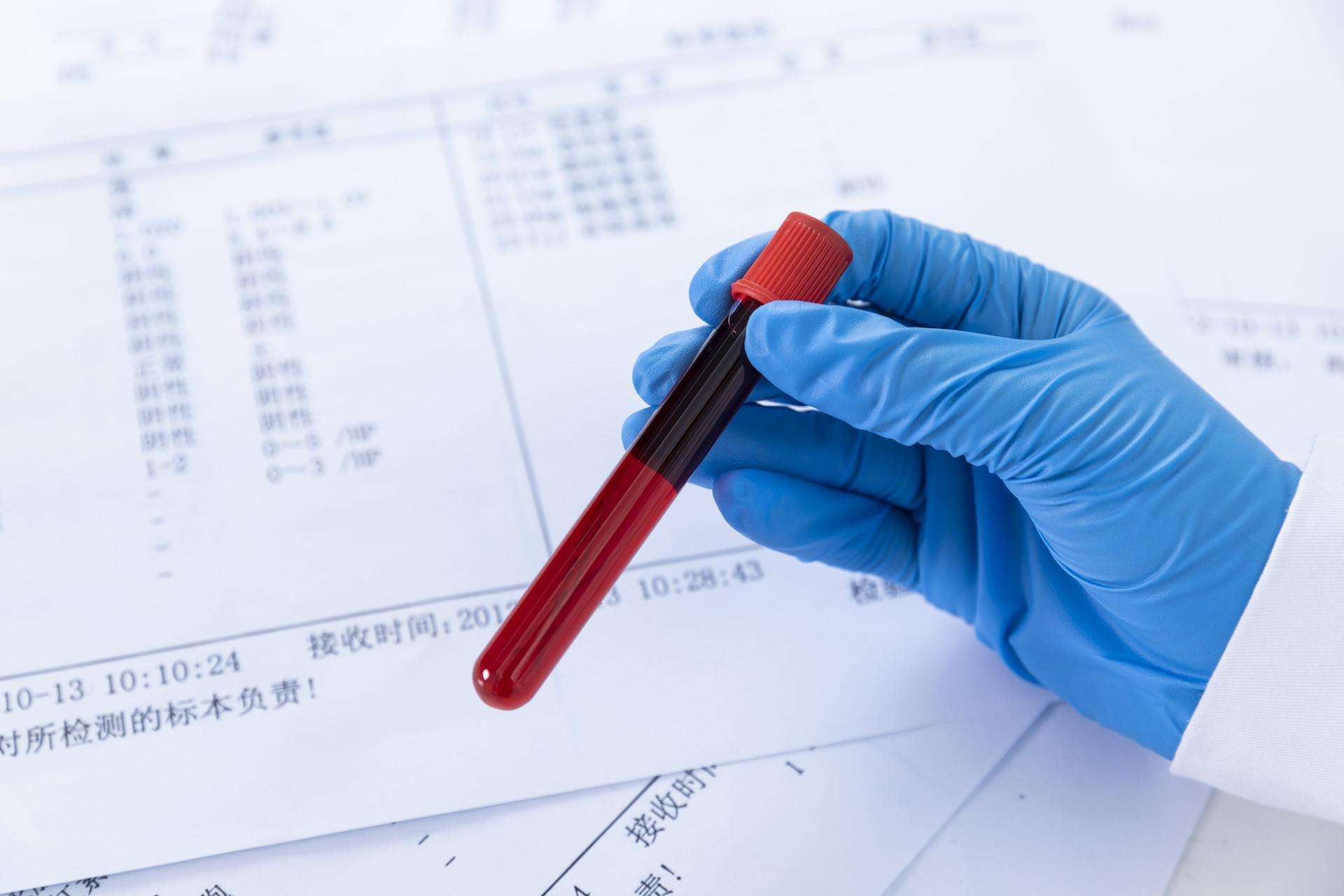 尿糖和糖尿病的区别,尿糖数值多少是糖尿病