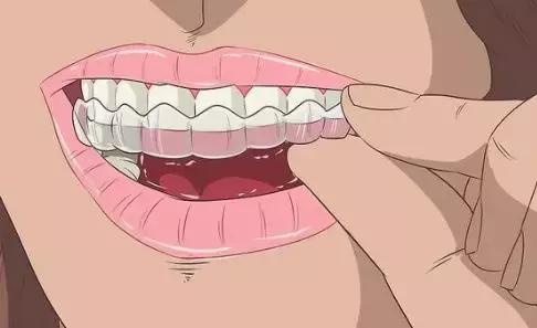 找了3个大学妹子聊聊:为什么在最美好的年纪戴牙套