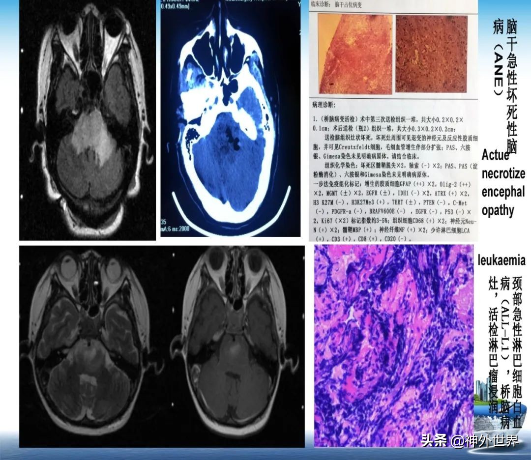 宣武医院神经外科王亚明祖籍,北京宣武医院神经科专家王亚明