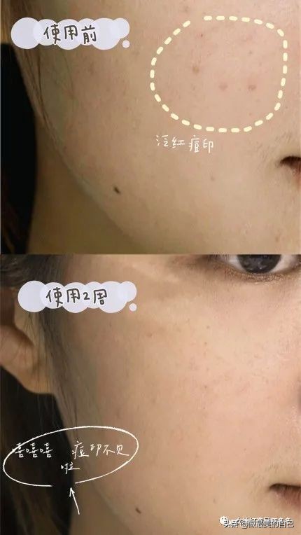 斑点暗黄肌最全的改善小技巧,都在这里