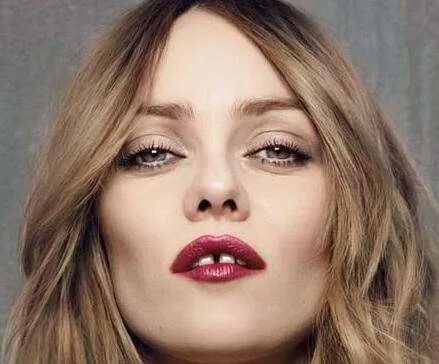 牙龈肿痛吃药不好,上火引起牙龈肿痛十大消炎药