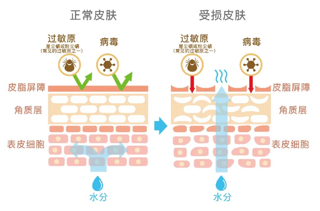 入冬脚后跟起皮粗糙干裂怎么办,男默女泪什么原因