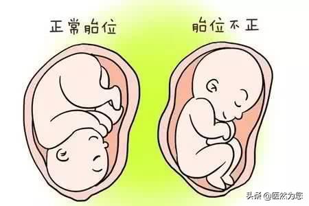 孕期总担心胎儿不健康怎么办,孕妇胎位不正医生纠正标准动作
