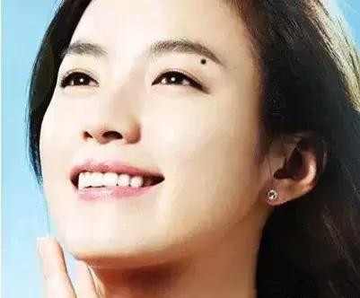 人各有痣不能勉强,人分别有哪些痣