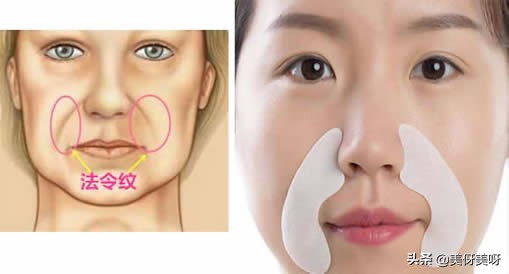 法令纹深怎么去除法令纹,法令纹怎么消除四种方法帮助你