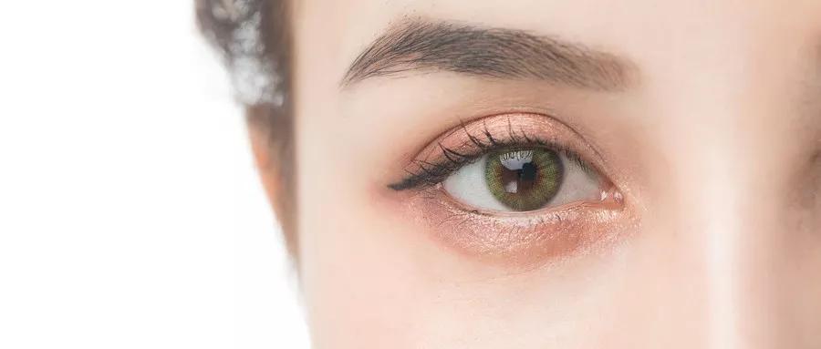 红斑狼疮患者护眼五步骤,还你一双BlingBling大眼睛