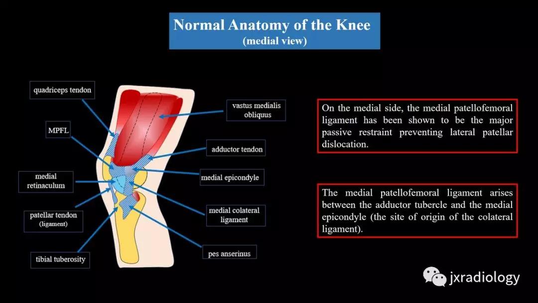 髌股关节失常磁共振看什么,髌股关节混乱的影像评估