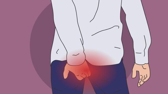 治疗痔疮最好的软膏,外痔疮最好治疗办法