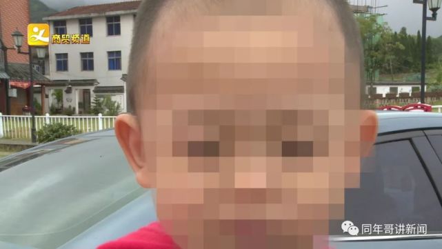 一岁宝宝看灯光有什么伤害,孩子去医院检查被灯光吓到