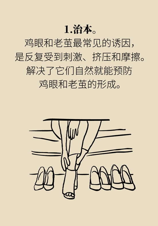 长了鸡眼该怎么办四大妙招教给你,长了鸡眼怎么治疗好得快