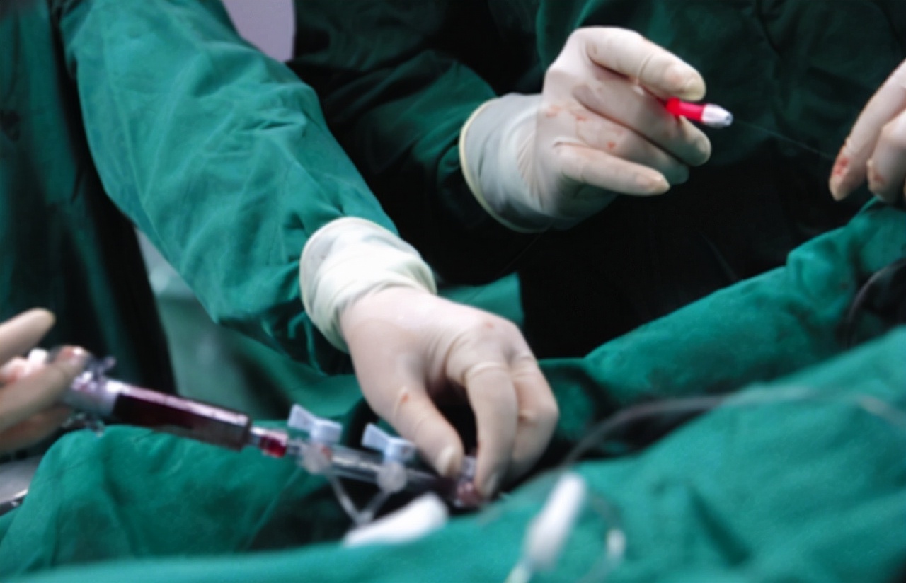 被公认为3种“最疼”手术，很多人或经历过，不妨提前了解一下