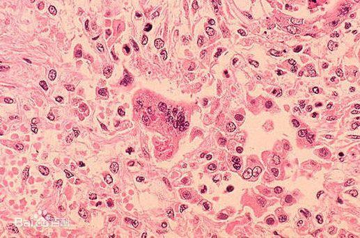 科普向——战“疫”进行时！三分钟看完世界病毒发现史！