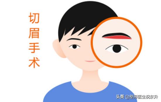 切眉后眼皮有褶皱怎么回事,切眉术后眼皮有褶皱能恢复吗