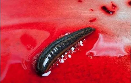 暴雨期间要当心吸虫,暴雨过后要当心血吸虫