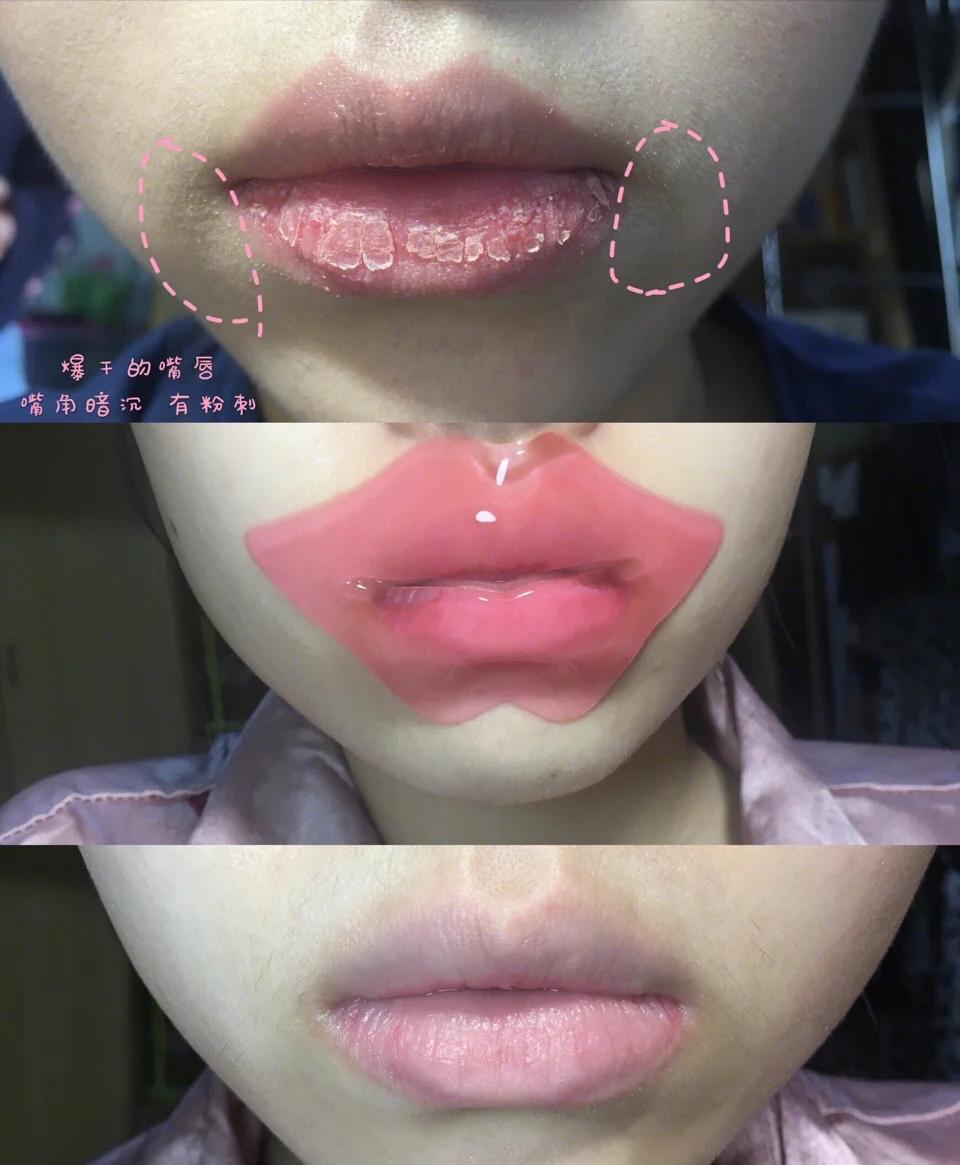 嘴唇好丑怎么变好看,嘴唇为何会越变越难看
