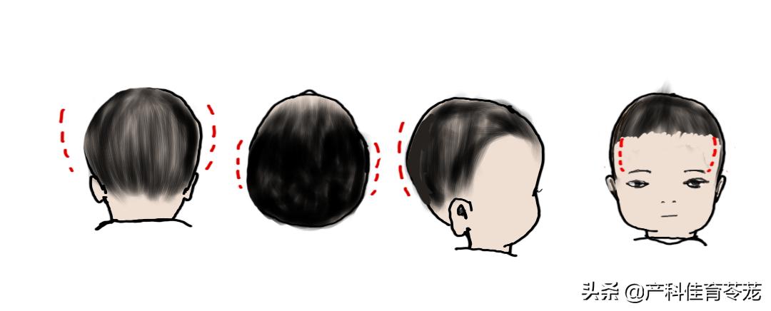 婴儿枕太高危害,婴儿定型枕危害