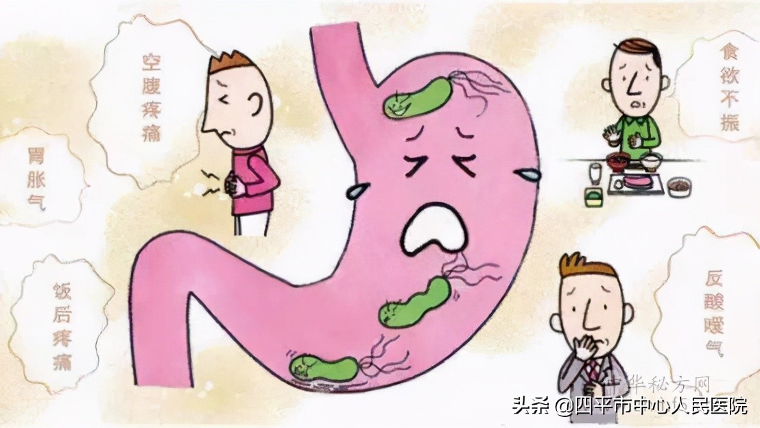 口腔溃疡你应该了解的知识,消化道溃疡是什么症状