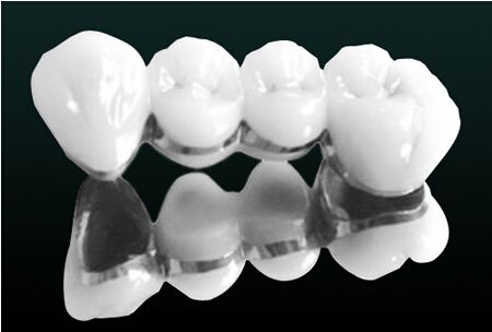 一个月工资种牙,一年工资不够种牙