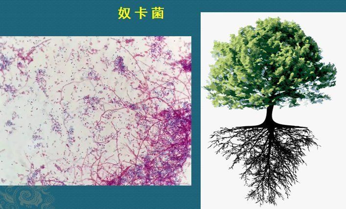 这个细菌提醒你，别买病死的鱼，它是个吃草的细菌，后来学会吃鱼