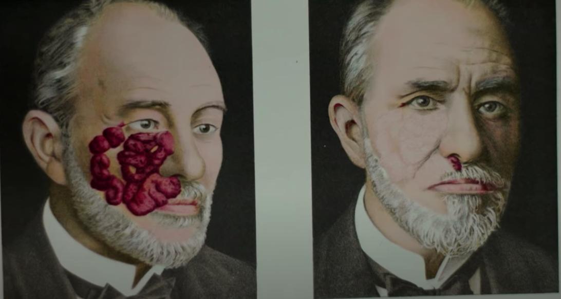 牙齿烂光，脸长巨瘤，骨头还会发光，被美国资本家逼向绝路的女工