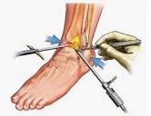 医学基础知识关节学,关节镜前世今生