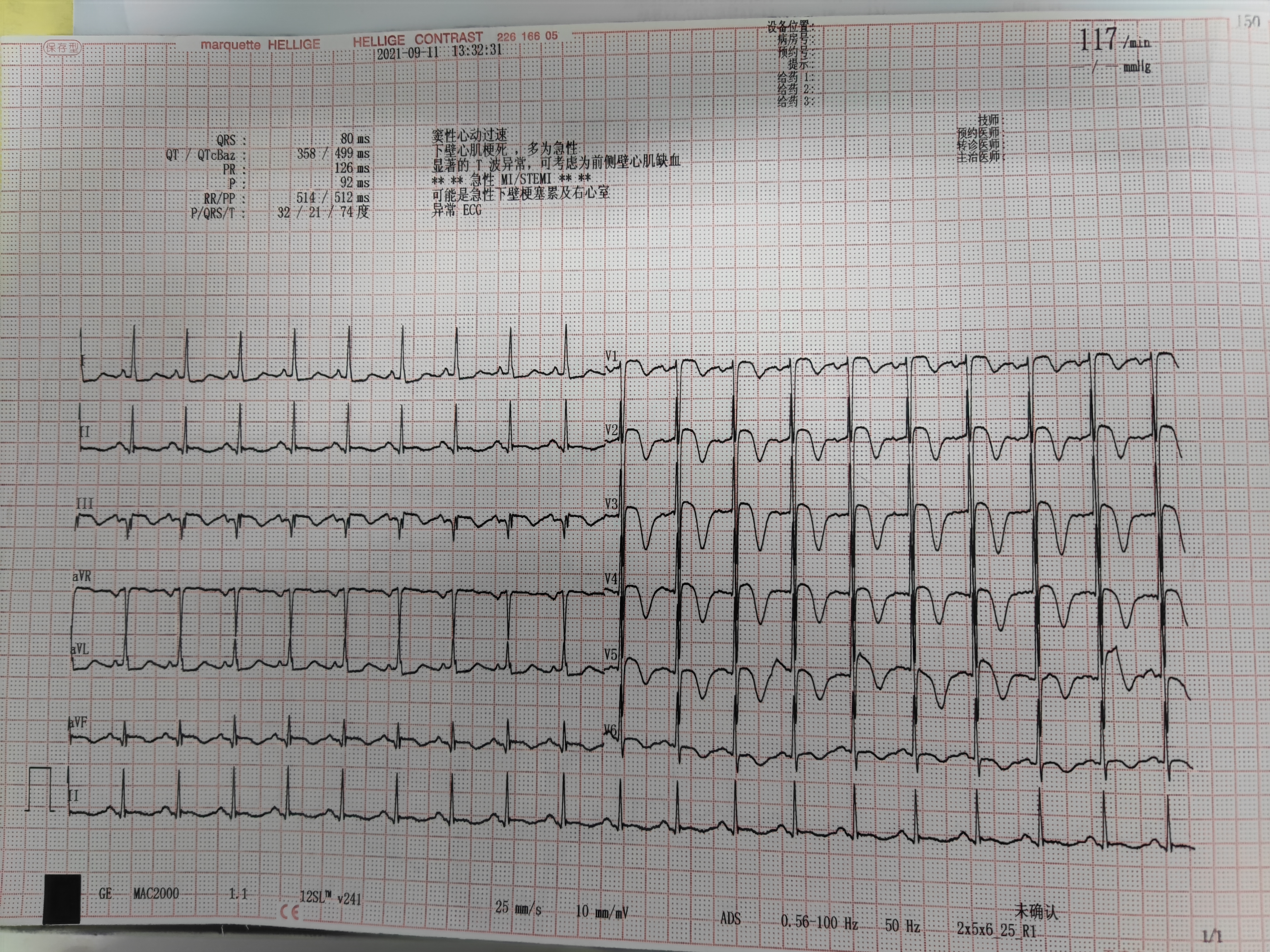 52岁女人有心慌是怎么回事,女52岁浑身到处是毛病