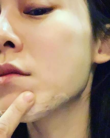 范玮琪摔倒陈建州,范玮琪摔伤的原因