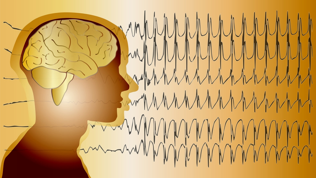 癫痫病最佳护理方式,癫痫病最好的护理方式