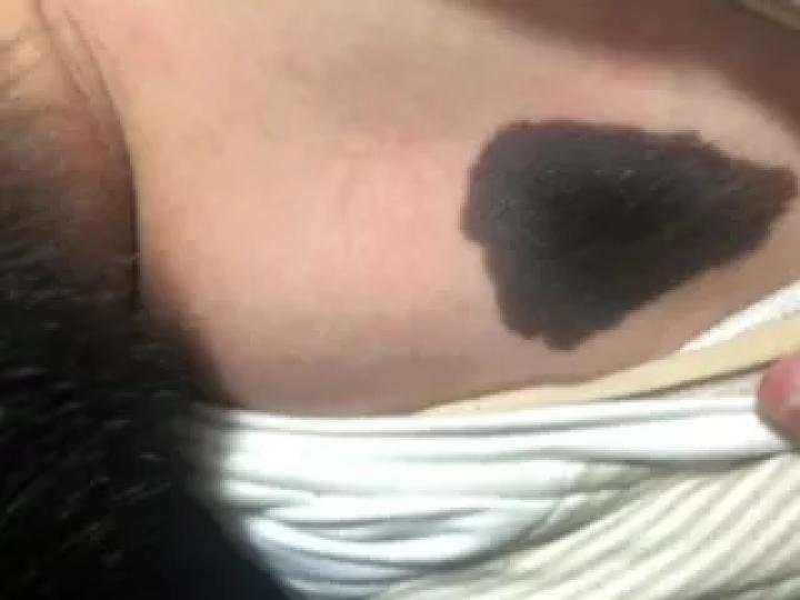 哪些部位长痣预示一生劳碌,痣的位置预示着什么