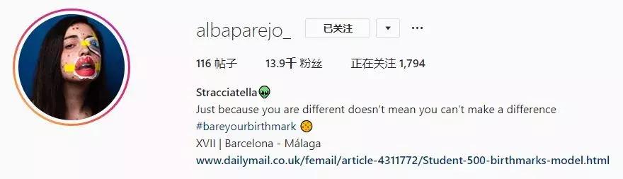 全身黑斑被骂“斑点狗”，身高160的她却成为最美超模…