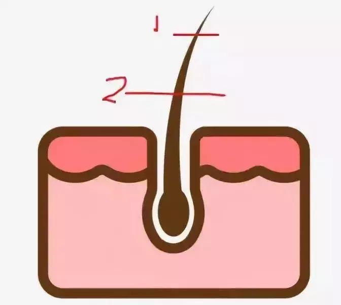 8种脱毛方法了解一下,我试过的5种脱毛方法哪种最有效