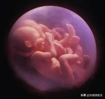 免疫相关高危妊娠,免疫相关不良妊娠答疑