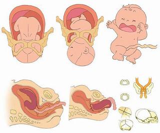 顺产好还是剖腹产好看,剖腹产两次了第三胎顺产经历