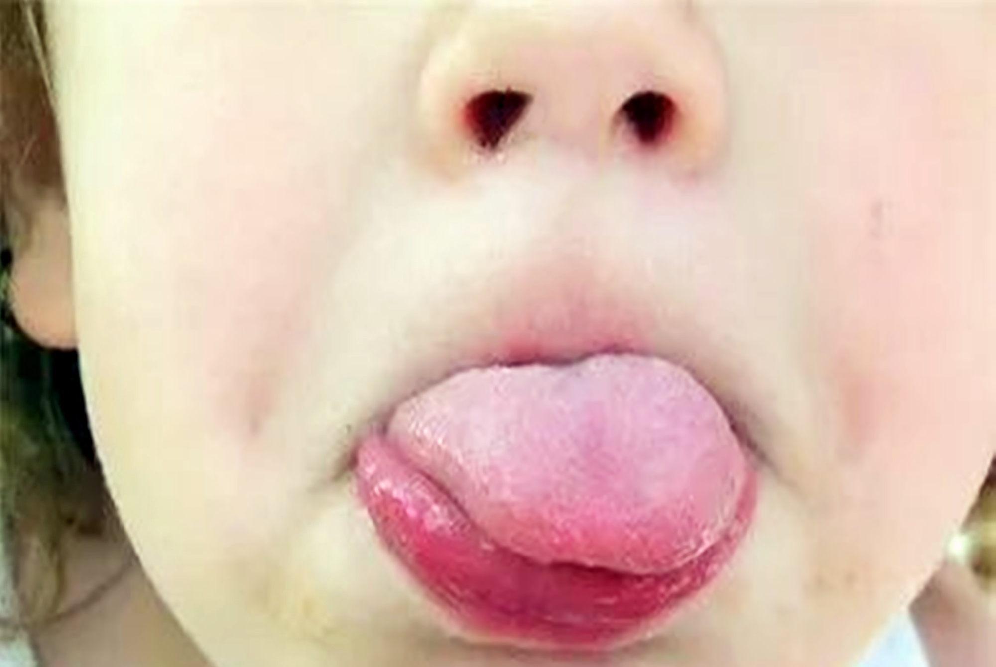 婴儿湿纸巾测评维达,婴幼儿湿纸巾酸性多的好吗