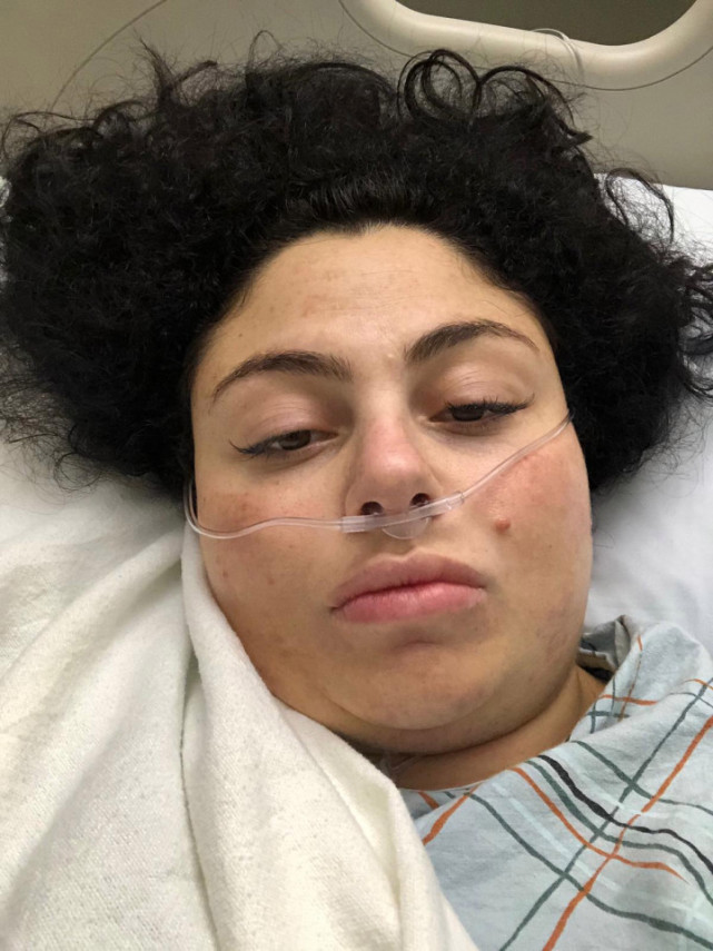 美国女子剖腹产后差点死亡,称伤口感染后身体发出一股恶臭