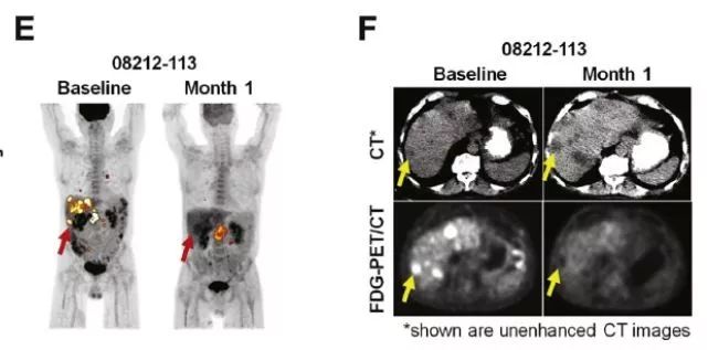 CAR-T细胞技术,car-t细胞最新突破