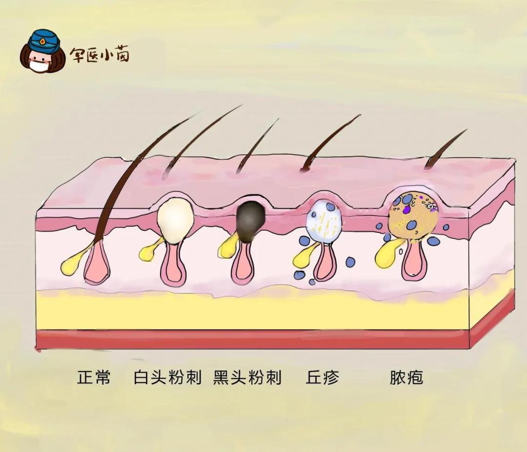 军医小茵丨今日立秋