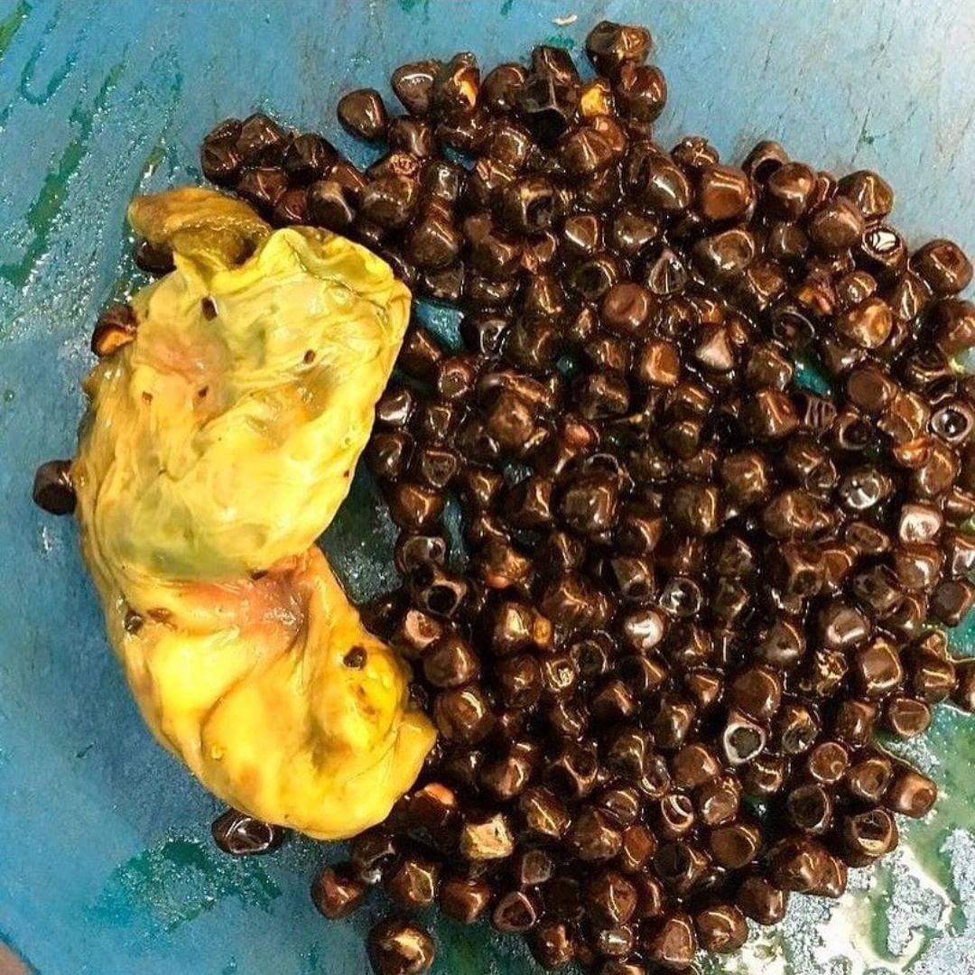 外科切下来肉该怎么处理,医院里手术切下来的东西哪里去了